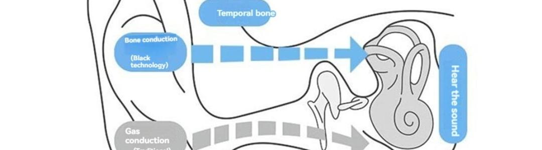 Костная проводимость звуков