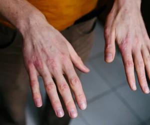 Руки и холод