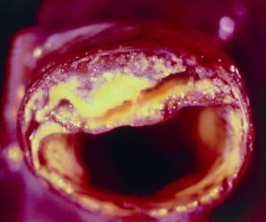 Бомба замедленного действия