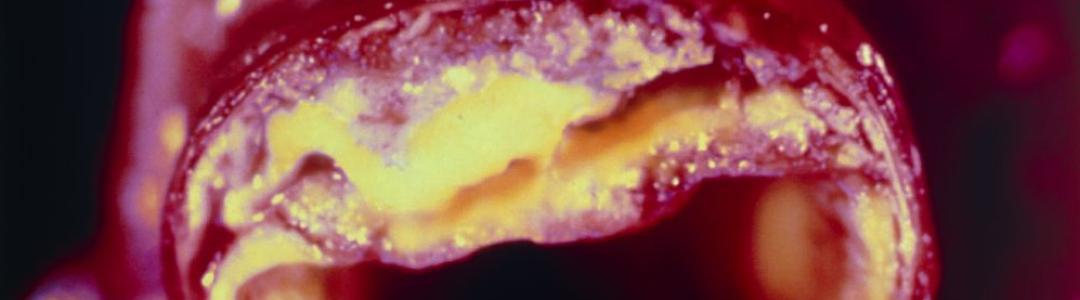 Бомба замедленного действия